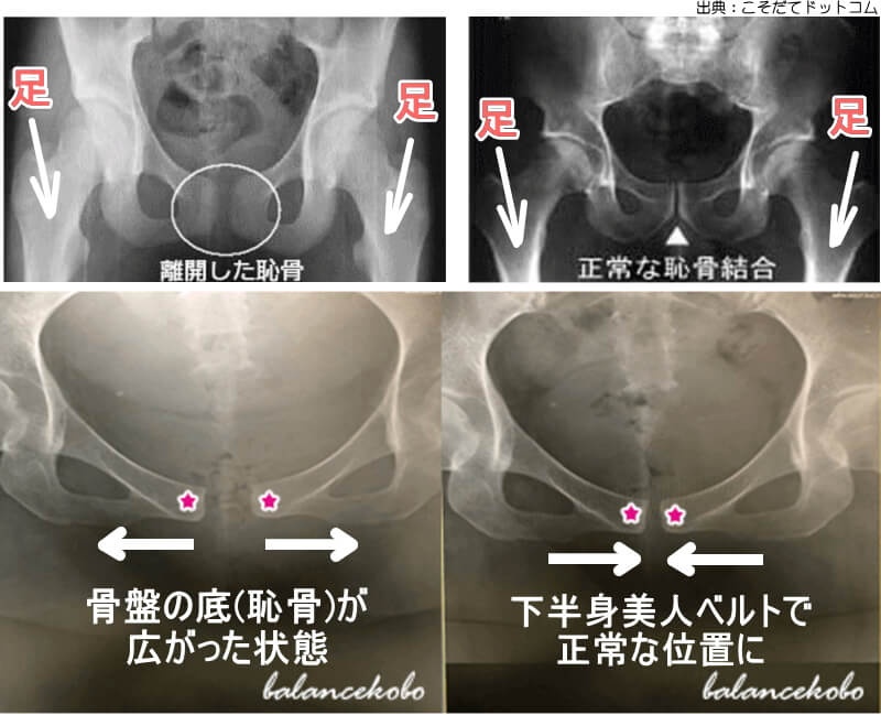 日本骨盤臓器脱研究所　バランス工房　下半身美人ベルト健康用品