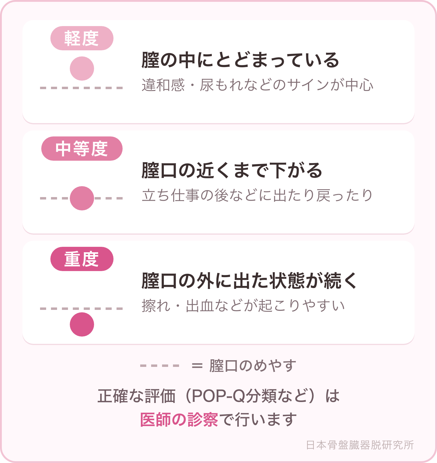 図解：骨盤臓器脱の進行度の考え方（軽度・中等度・重度）。正確な評価は医師の診察で行います